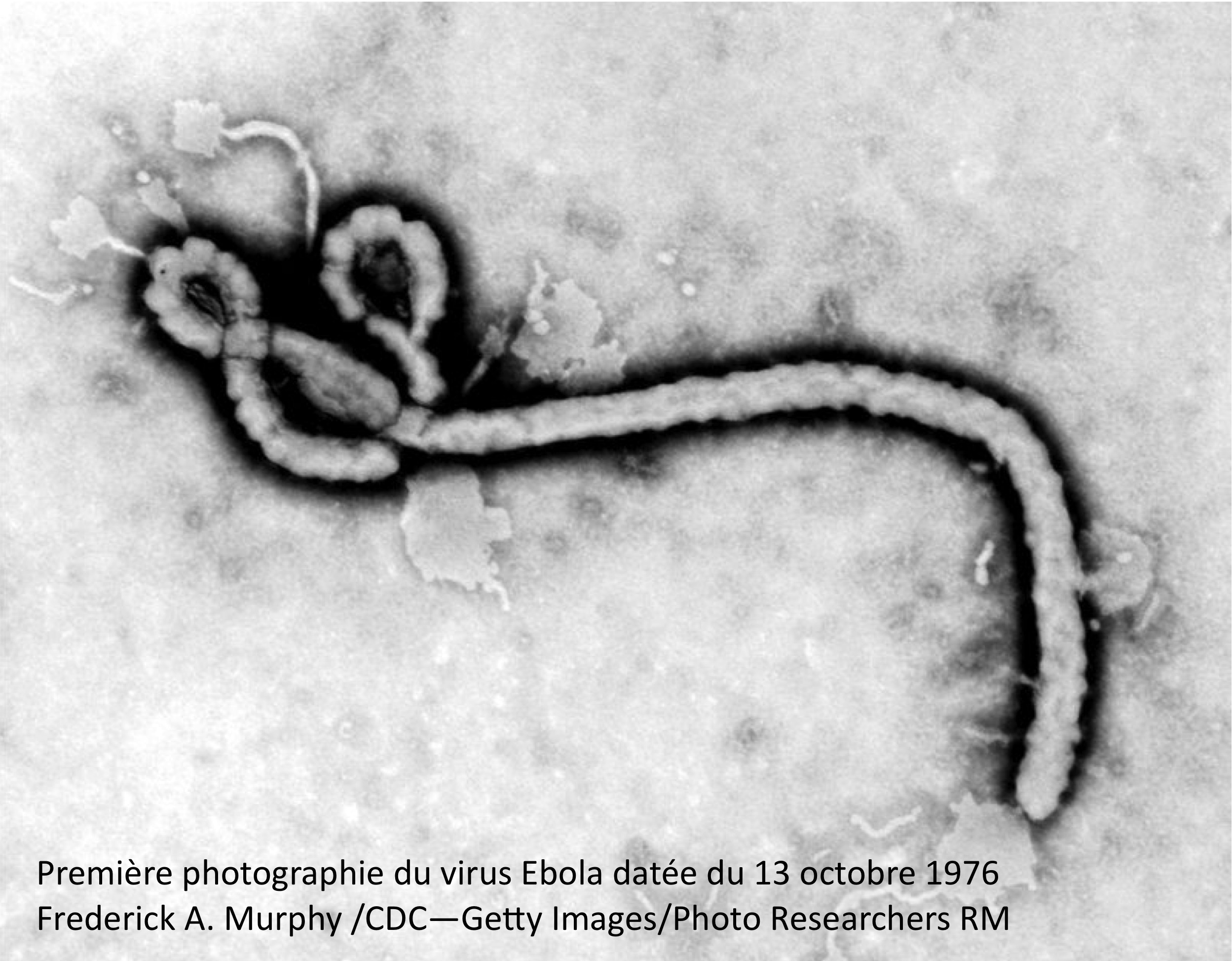 Ebola