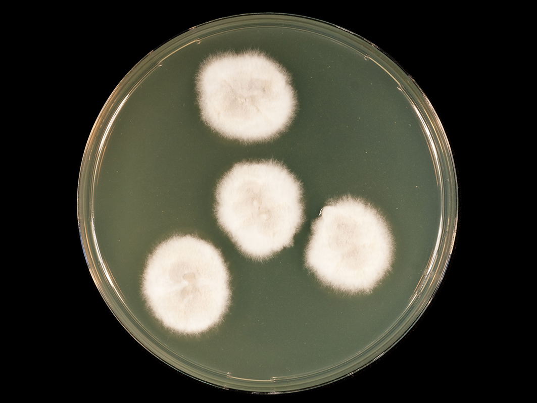 Scedosporium apiospermum 1