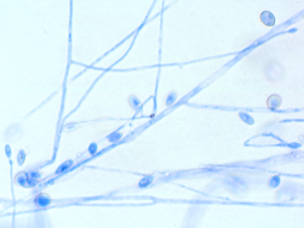 Scedosporium apiospermum 2