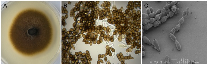 Site web SFM - Section mycologie - Fungus of the month - Alternaria - Figure 1
