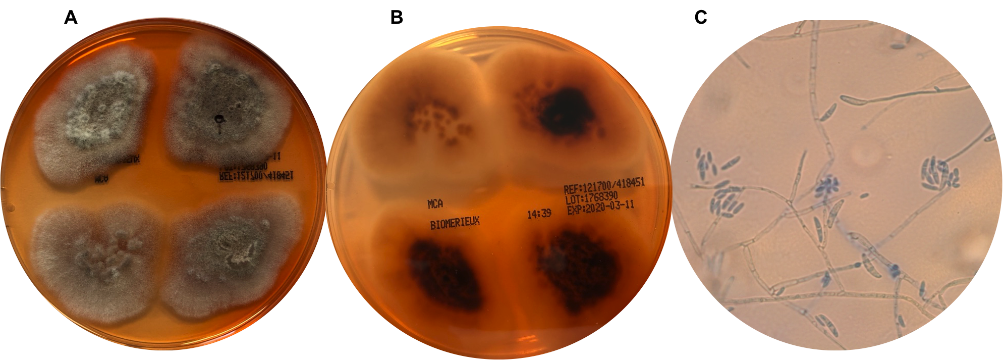 Fusarium