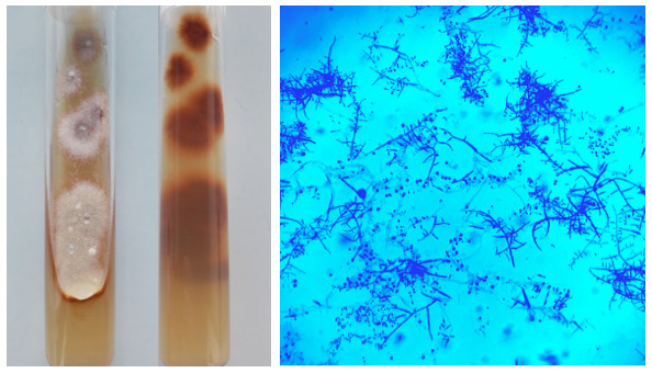 trichophyton tonsurans