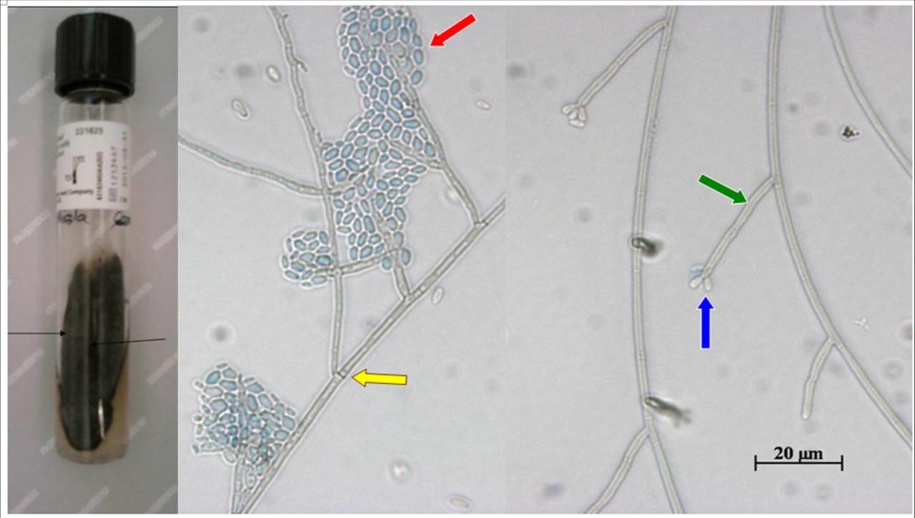 Figure 1-Exophiala jeanselmei (1)
