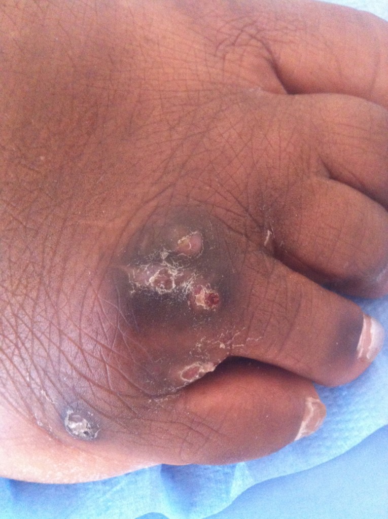 Figure 2-Exophiala jeanselmei (1)