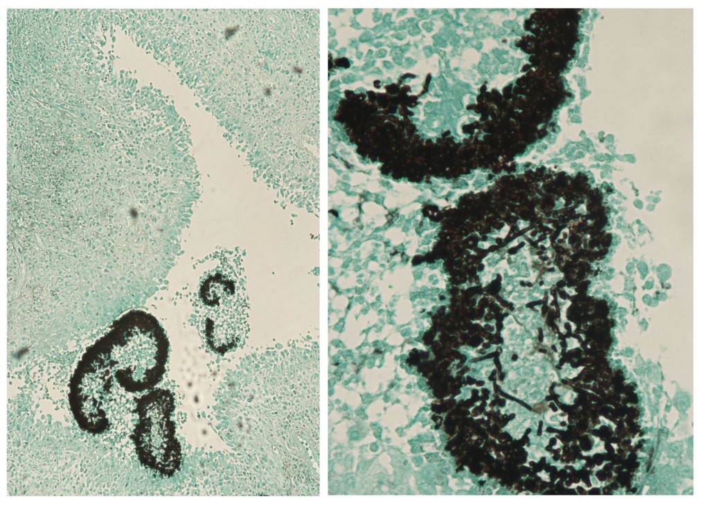 Figure 3-Exophiala jeanselmei (1)