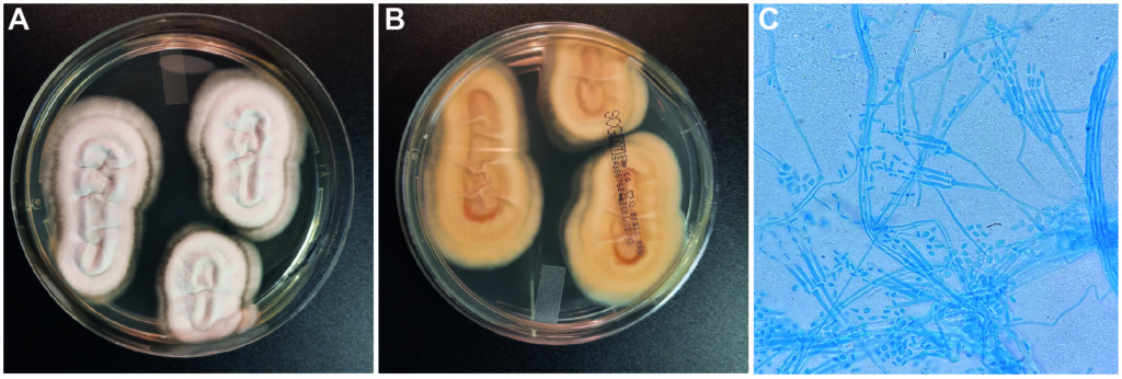 Le Champignon du mois - mars 2021 - Complexe Rasamsonia argillacea-Figure 2